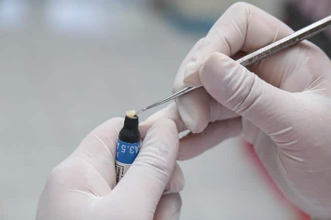 Gloved hands holding dental tool with blue component during dental procedure or examination.