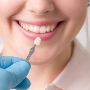 Dentist holding dental tool near patient's smiling mouth during examination or treatment.