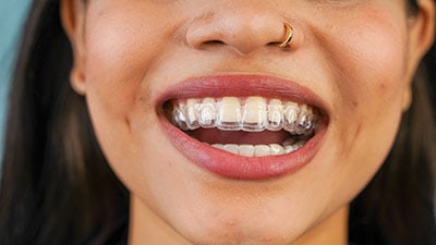 Woman smiling brightly, displaying healthy white teeth and gold nose ring against blue background.