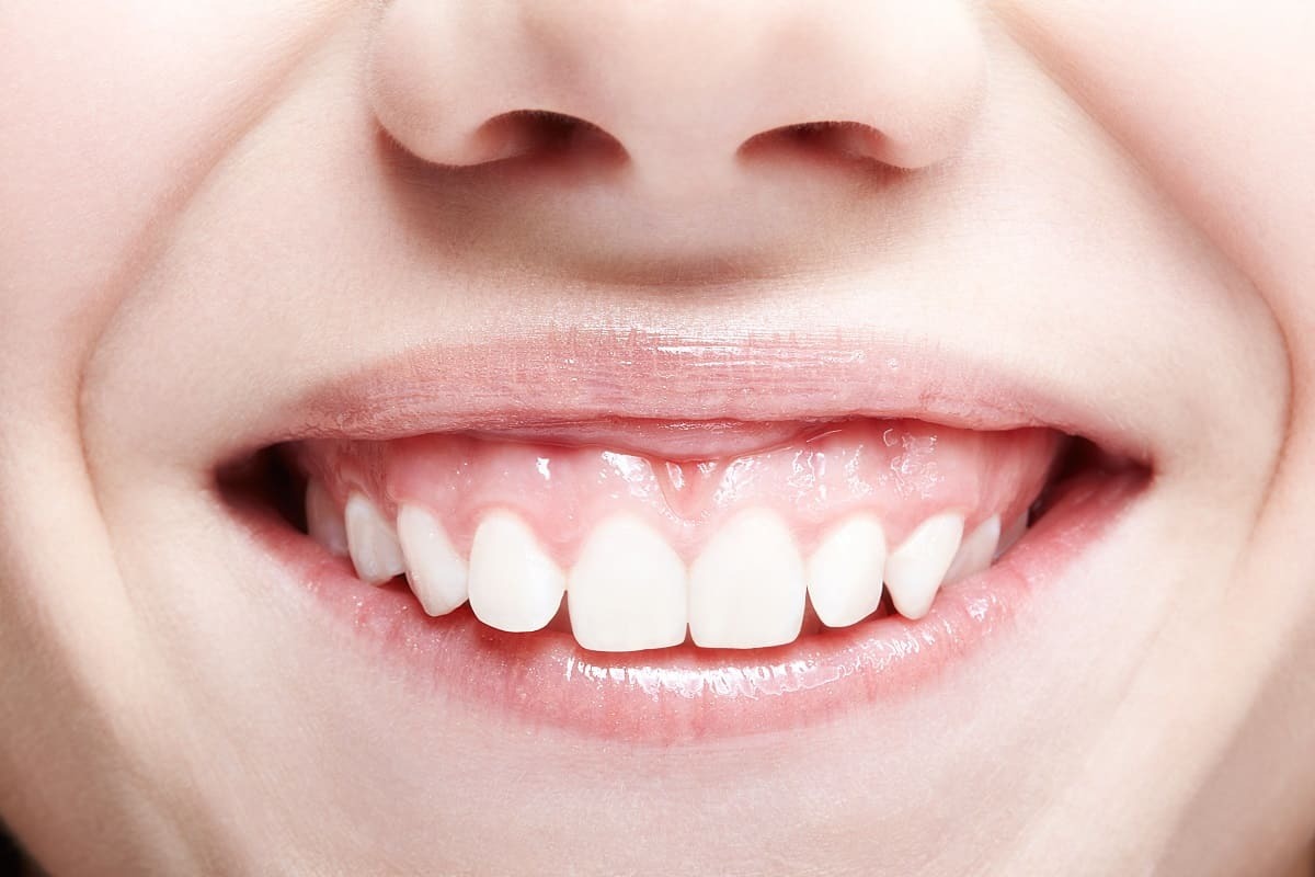 Close-up of a patient's bright white teeth and healthy pink gums displaying a beautiful smile.