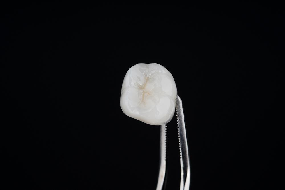 Reasons Our Dentists May Recommend a Dental Crown