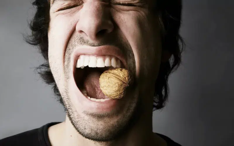 How Do Cracked Teeth Occur