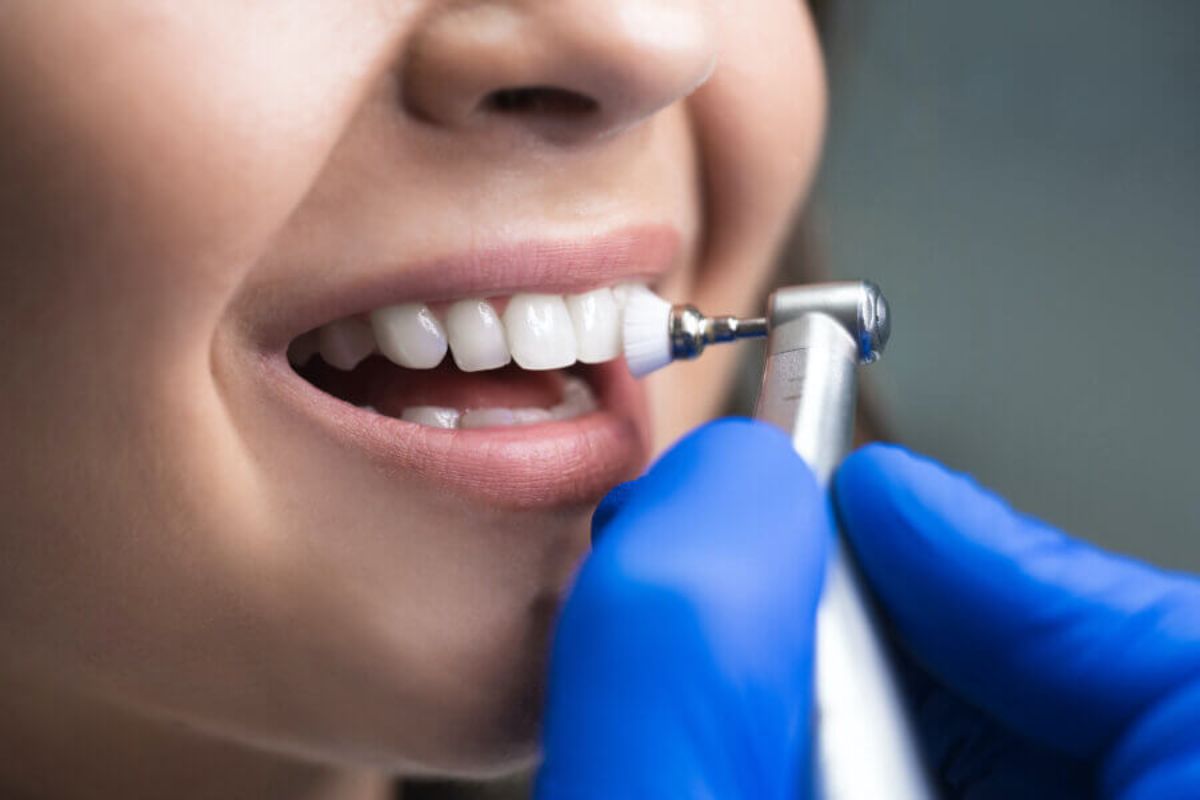 How Often Should You Schedule Teeth Cleaning Appointments