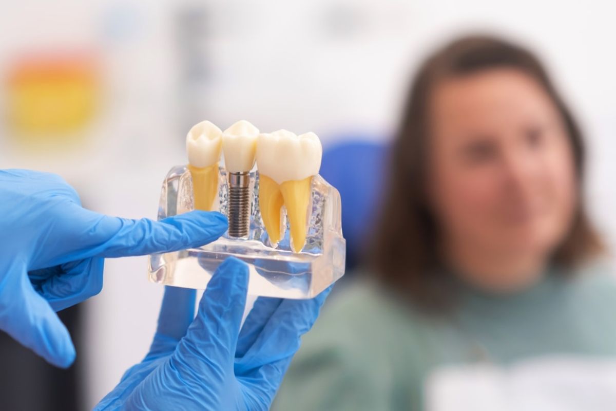 When Should You Repair or Replace a Dental Implant