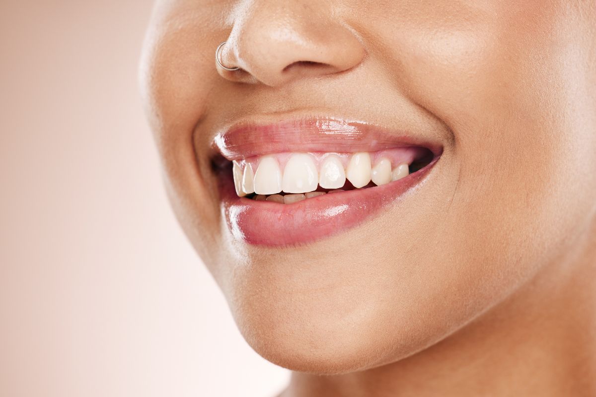 How Teeth Whitening Can Complete Your Smile Makeover