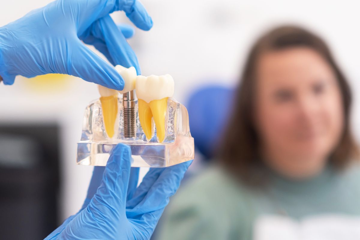 Can Smokers Get Dental Implants Successfully