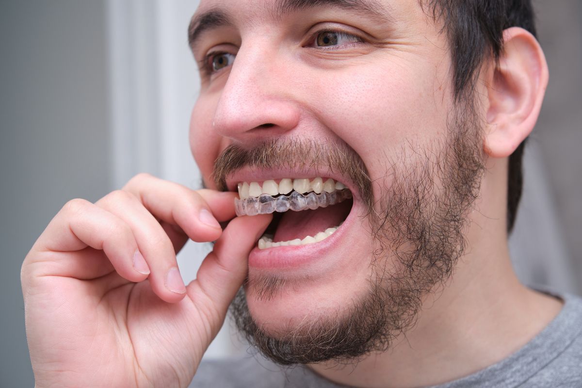 Why Choose Invisalign Over Braces for Better Comfort?