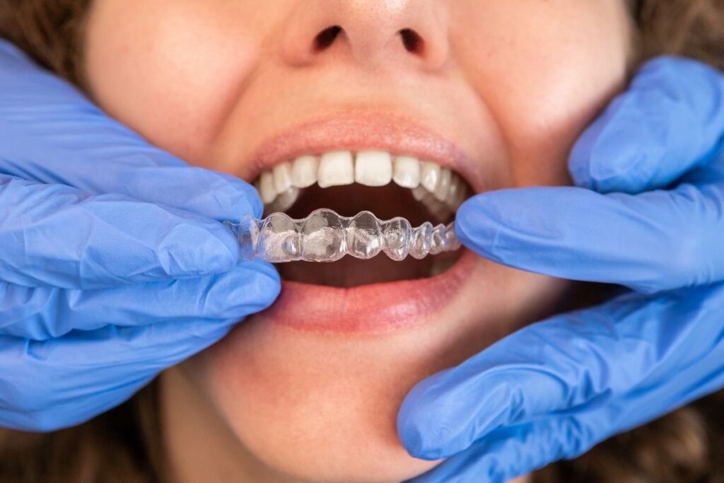 Seasonal Shifts and Your Invisalign Journey
